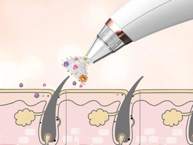 Blackhead Removal Vacuum Cleaner