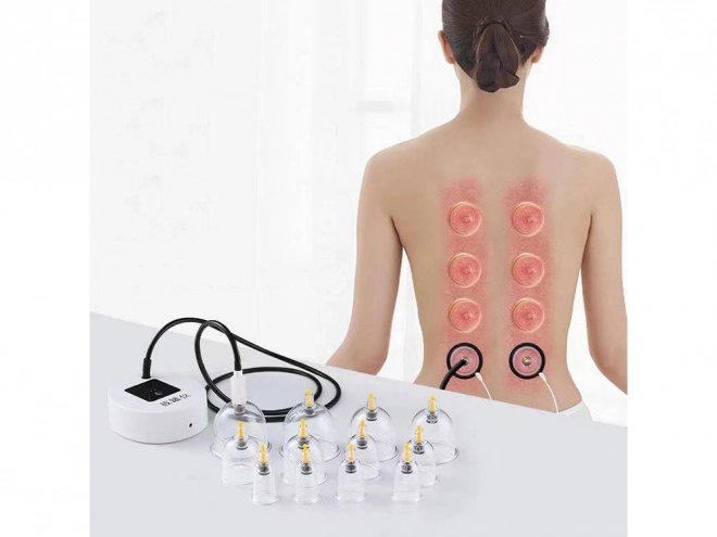 Elektrische Vakuum Massageschalen Set