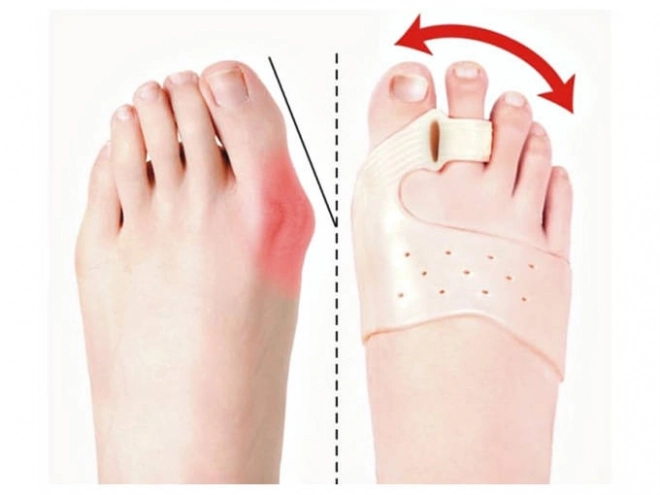 Séparateur d'orteils pour hallux valgus avec aimant